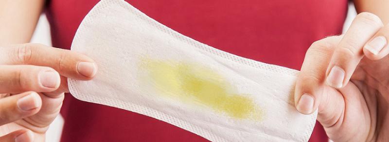 Açık Sarı Akıntı Belirtileri ve Tedavisi